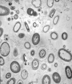 Figure 2: Microbes inside GBR sponge