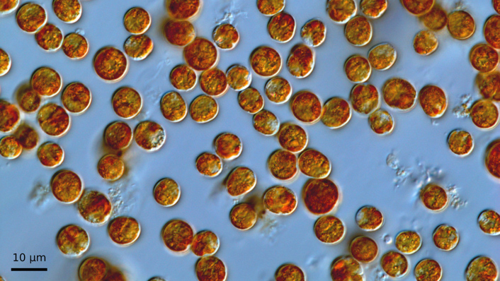A photo under the microscope of green/brown balls on a grey background. 