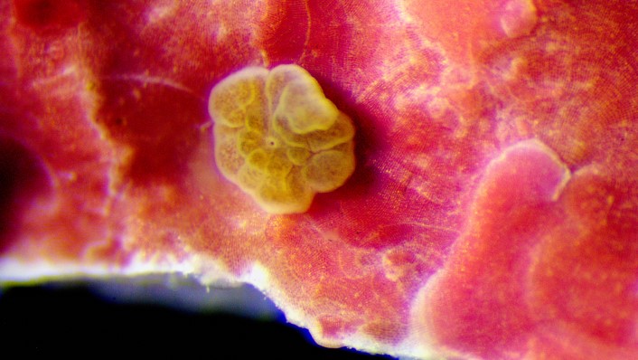 a tiny round beige polyp sits on a pink surface. The polyp is less than 1mm in diameter