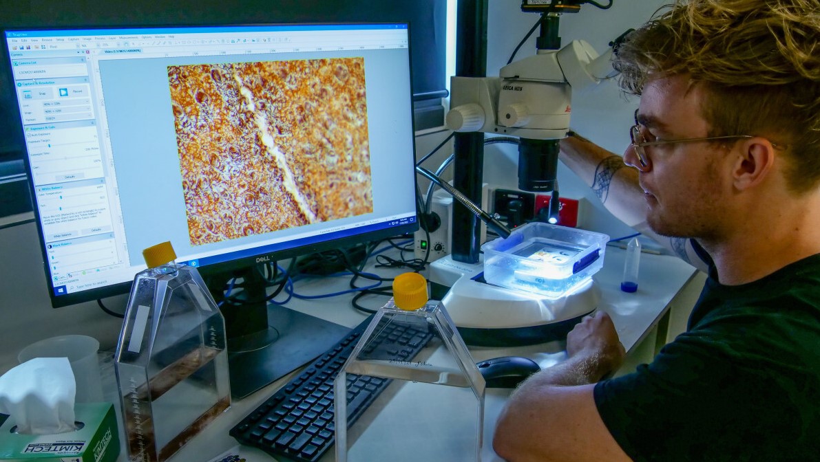 A man looks at a close up image of a substance on a computer screen