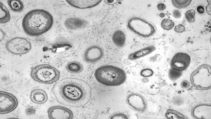 Microscopy image of diverse microbes living in a sponge