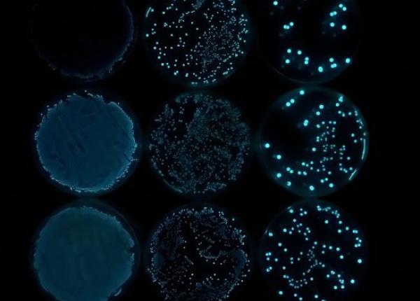 Several bacterial cultures on petri dishes