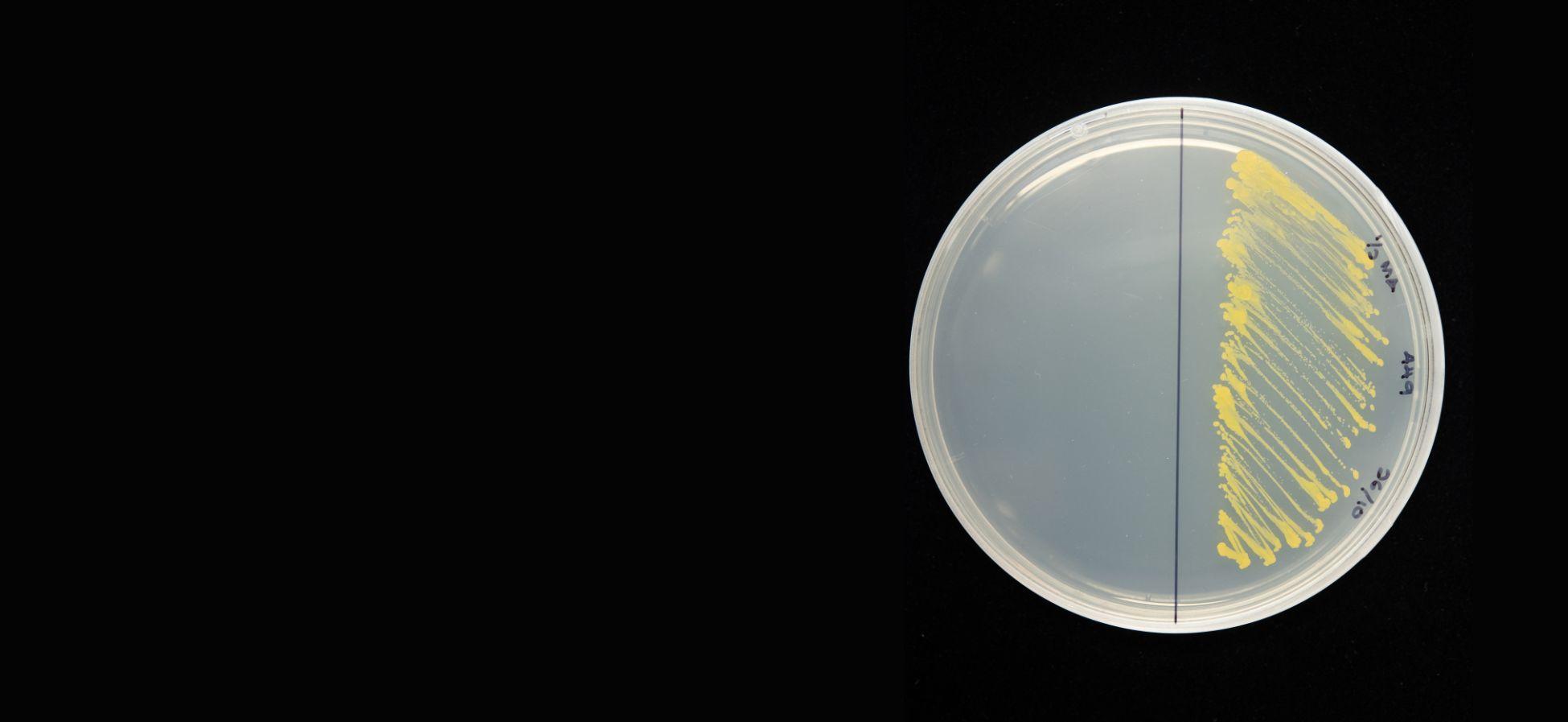 a petri dish with a yellow streak of what looks to be bacteria on it. the background is all black.