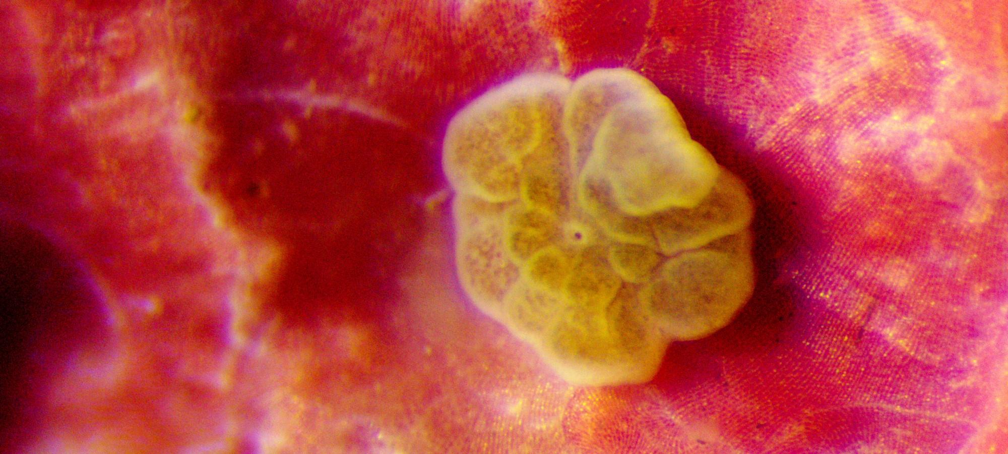 a microscope image of a single coral polyp on a pink hard algae background