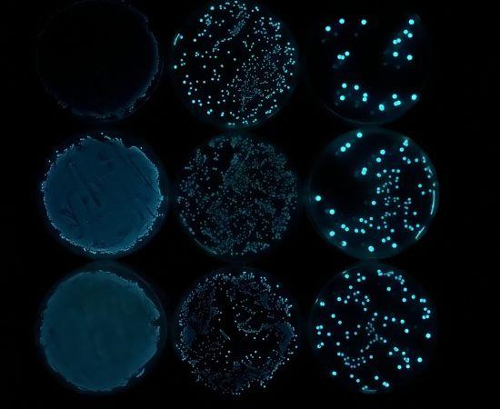 Several bacterial cultures on petri dishes
